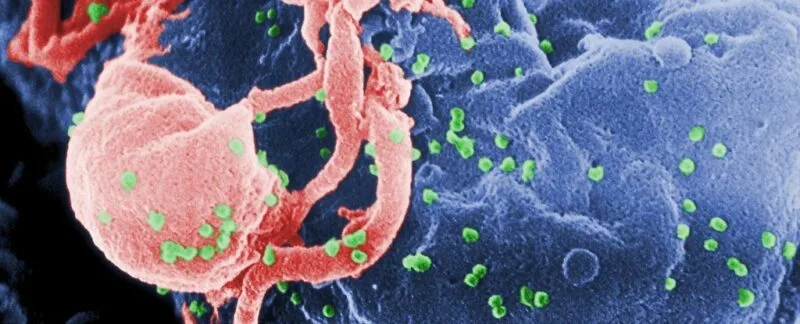 virus antic