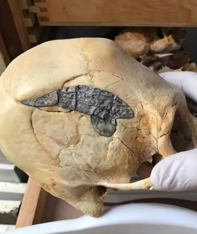 craniul din Peru