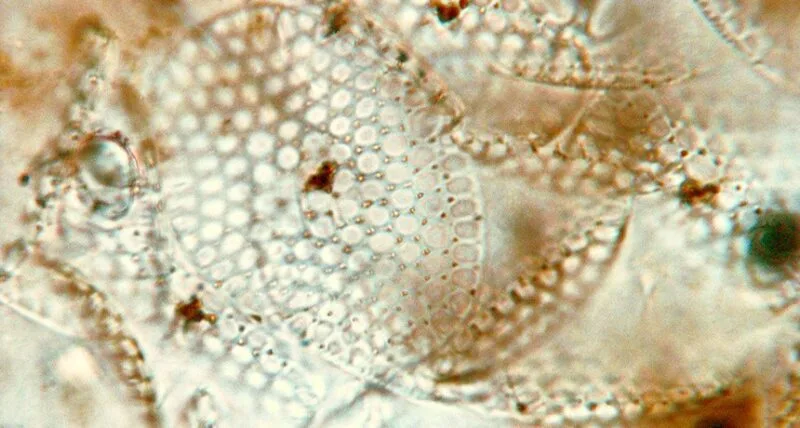 virusi stravechi