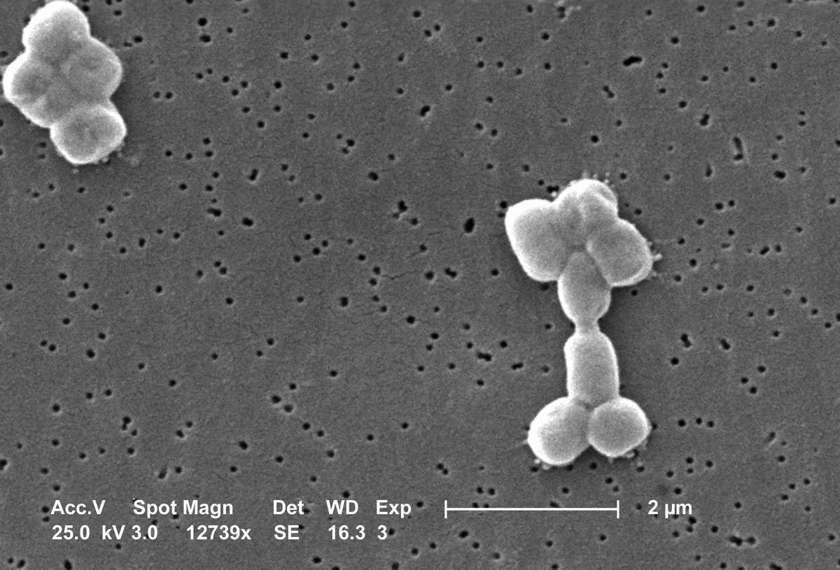 Acinetobacter baumannii SEM lores
