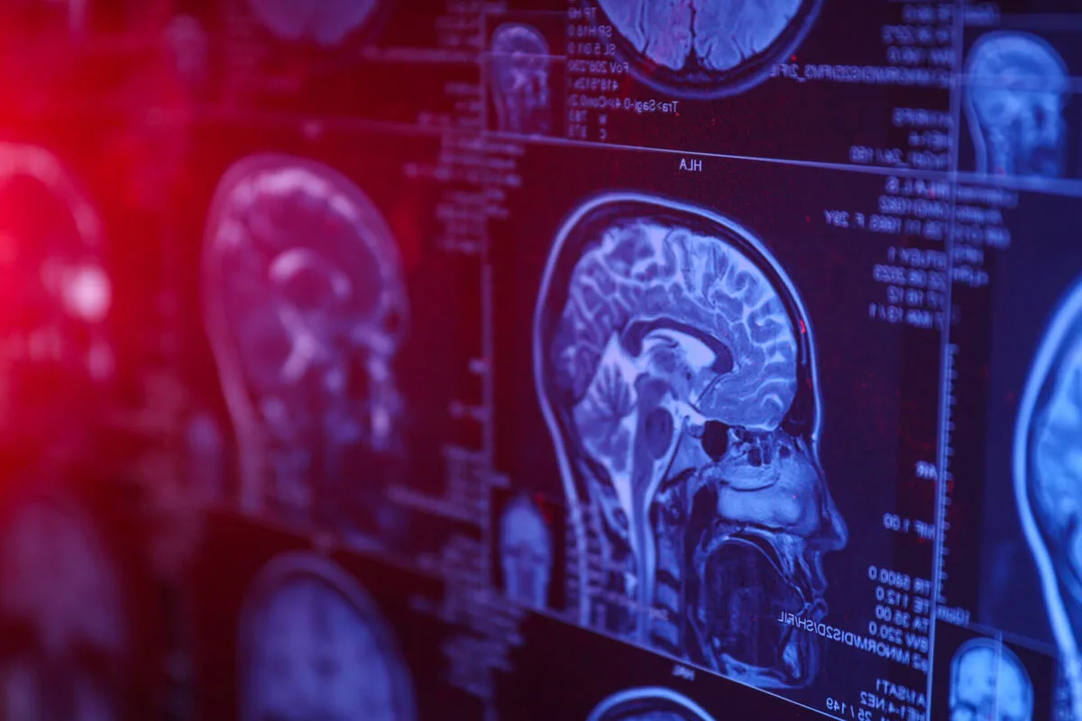 neuroni artificiali Neuroni artificiali
