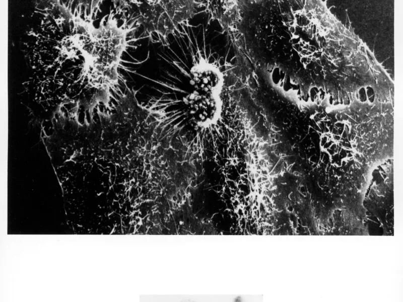 Micrografie electronică a unor celule canceroase HeLa, cu suprafață neregulată