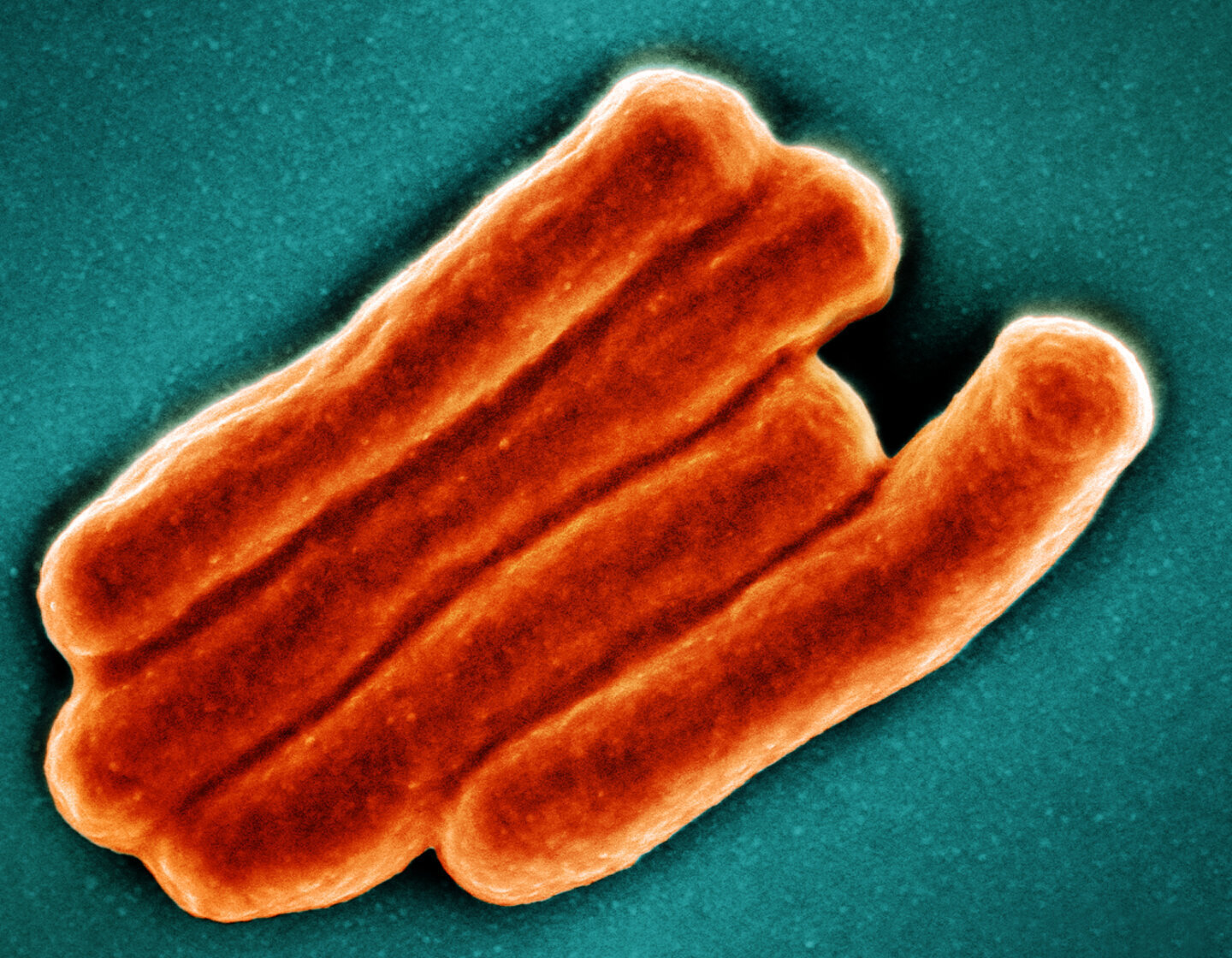 Bacteria Mycobacterium tuberculosis la microscop, exemplu de logica evoluției aplicată bolilor infecțioase