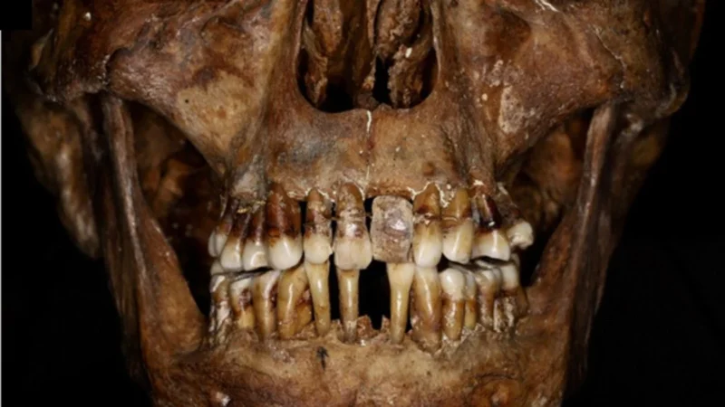 AncientTeeth