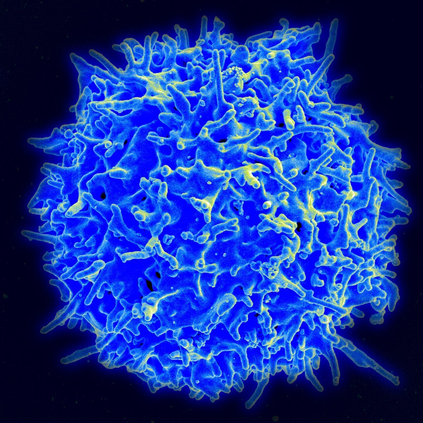 Limfocit T uman la microscopul electronic, tipul de celule imunitare studiat la supercentenari