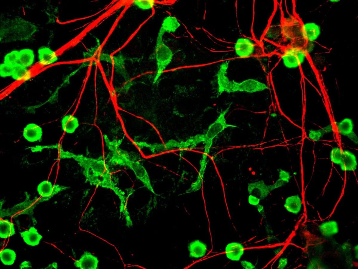 sistemul imunitar al creierului Microglii colorate în verde și prelungiri neuronale colorate în roșu într-o cultură de celule cerebrale