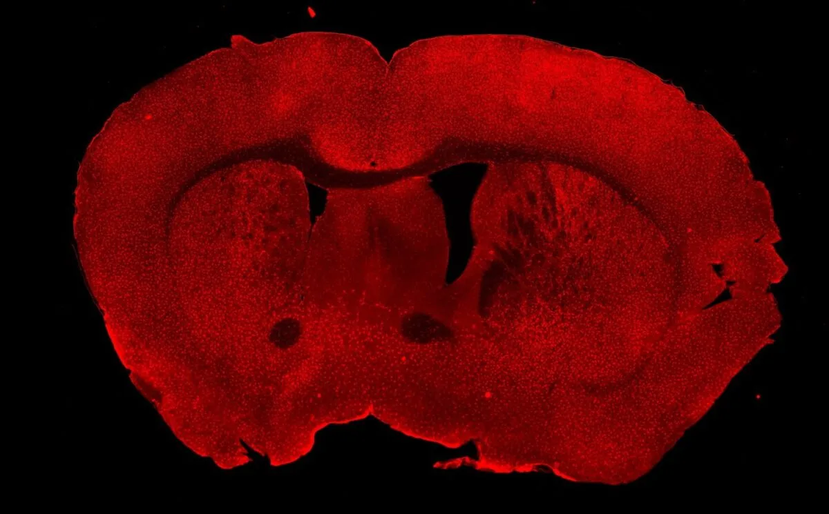 sistemul imunitar al creierului Sistemul imunitar al creierului: microglii marcate fluorescent în roșu într-o secțiune coronală de hipocamp