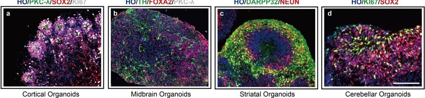 Organoizi din care se obține țesut cerebral uman, văzuți la microscop